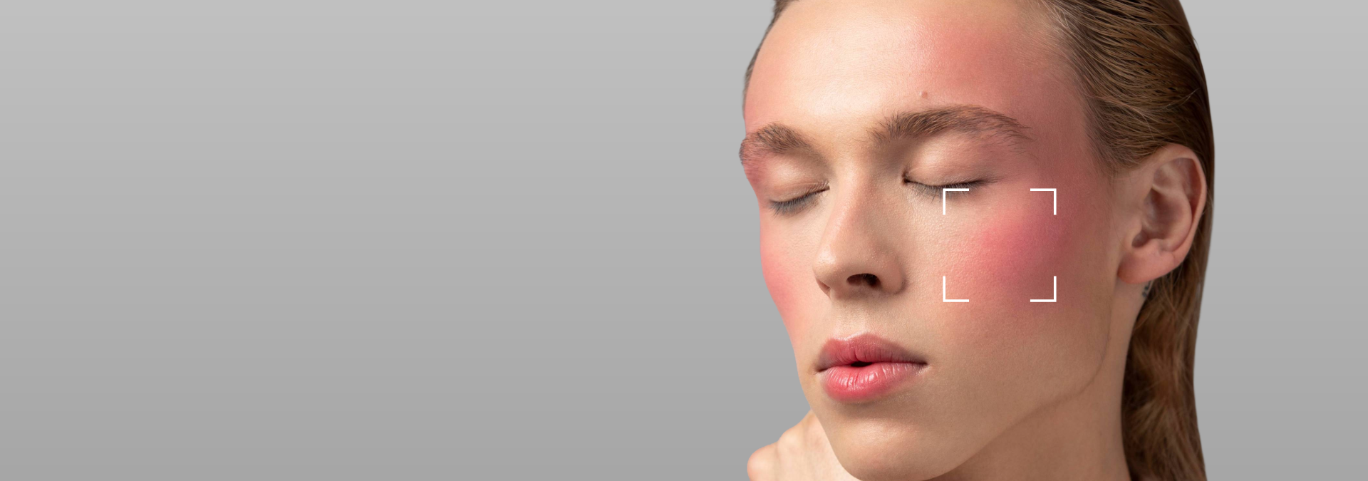 Sensitive Skin