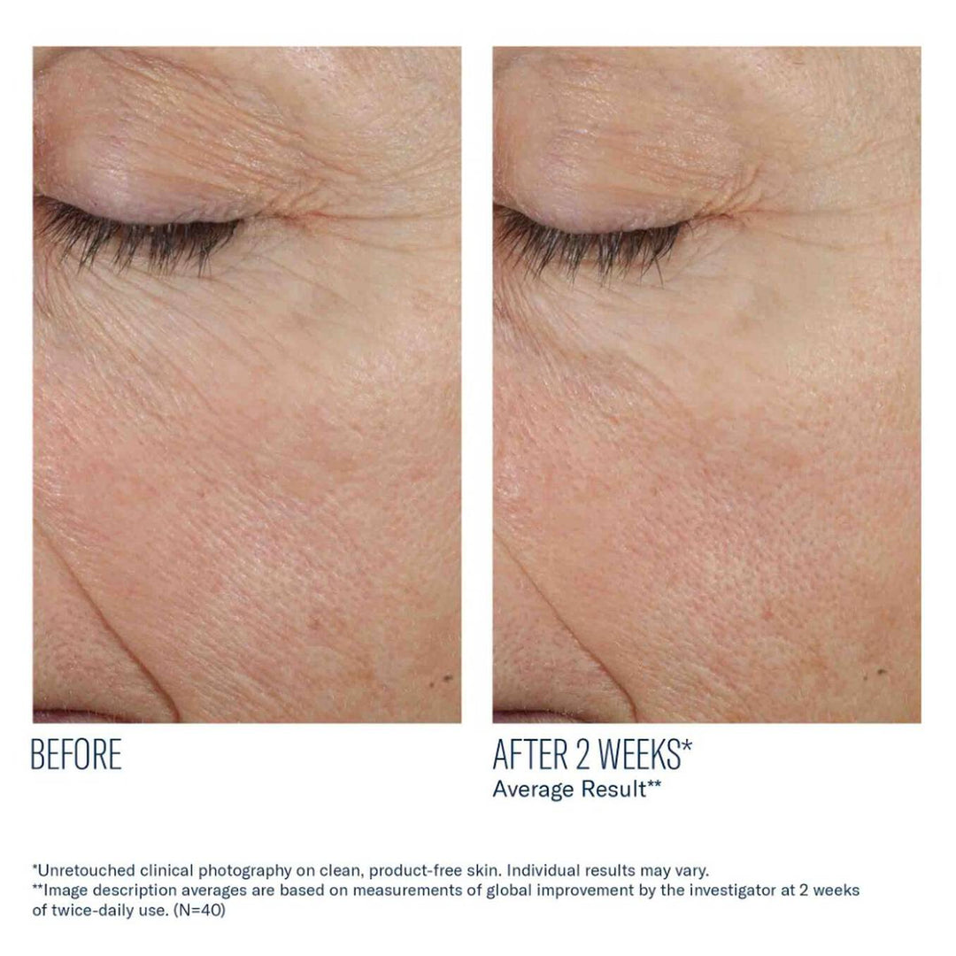 Trio Rebalancing Moisture Treatment
