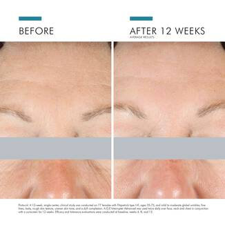 A.G.E. Eye Advanced