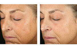 Alto Defense Serum
