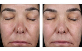 Alto Defense Serum