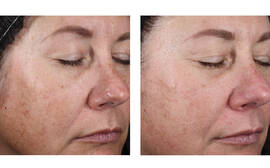 Alto Defense Serum