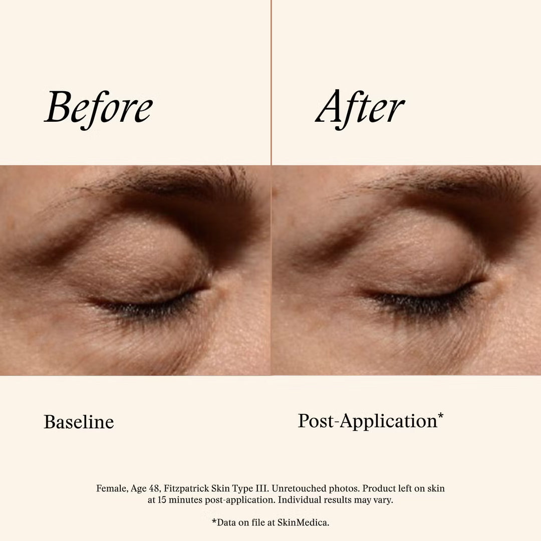 Instant Bright Eye Cream
