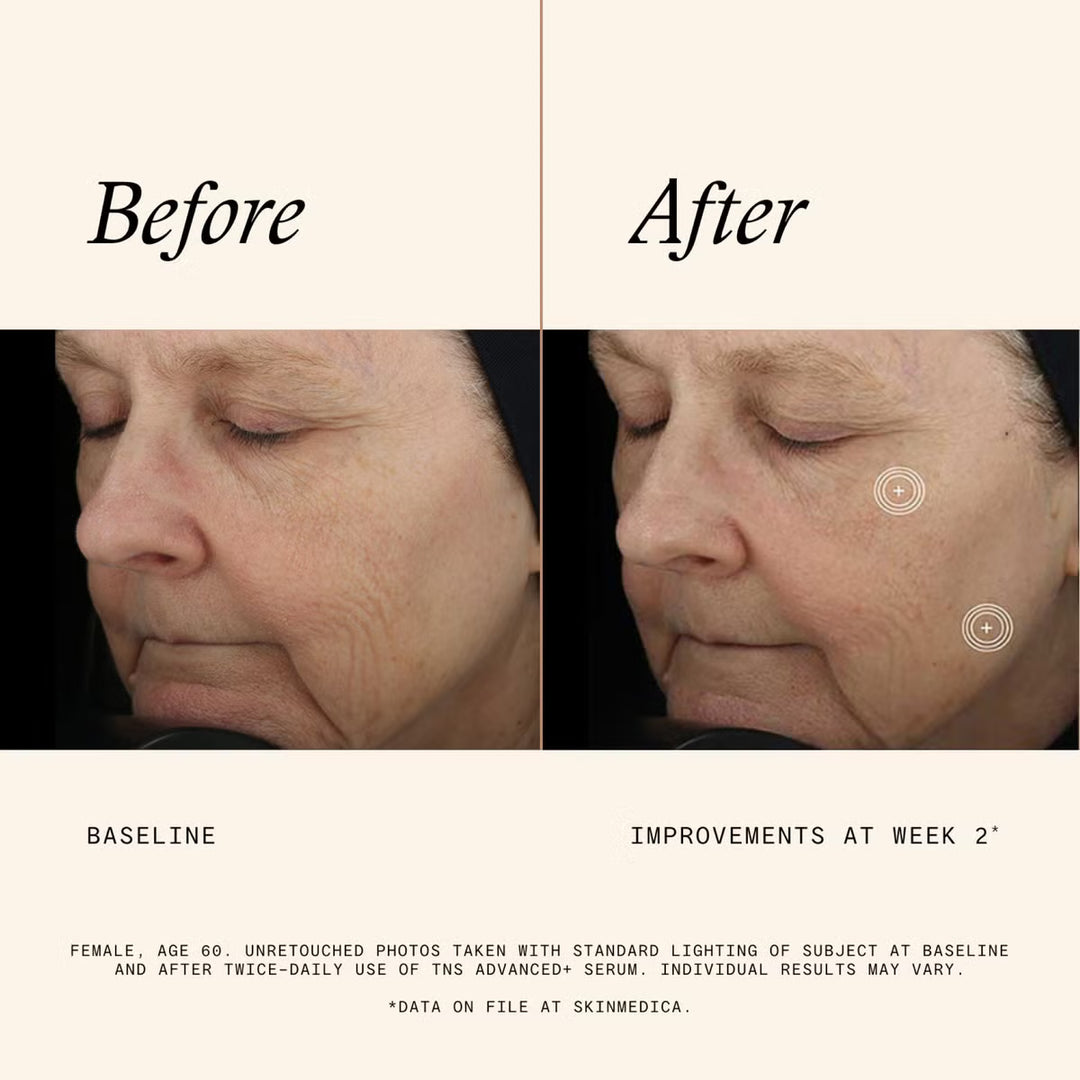 TNS® Advanced+ Serum
