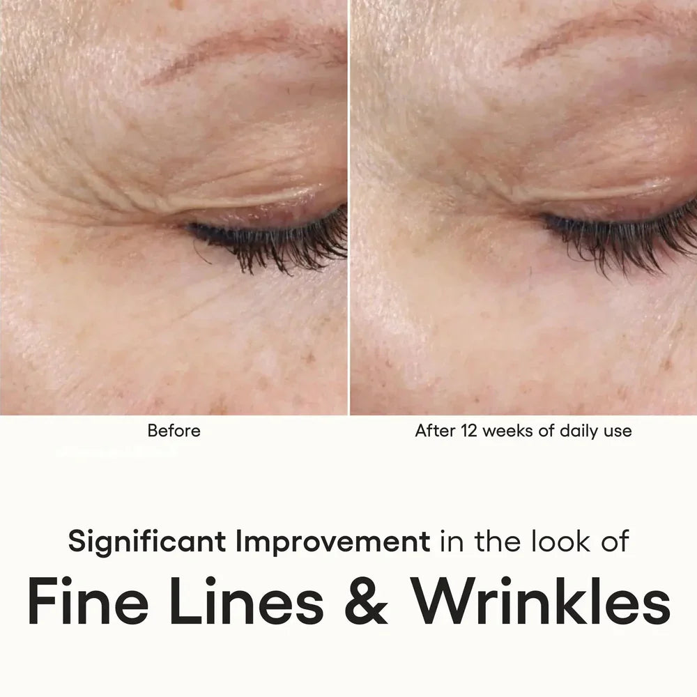 Intense Serum