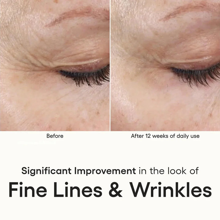 Intense Serum