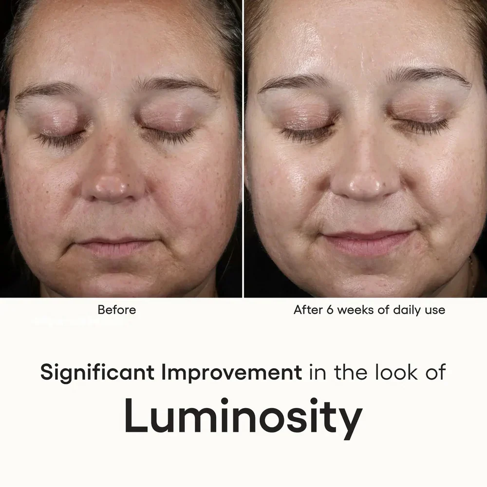 Intense Serum